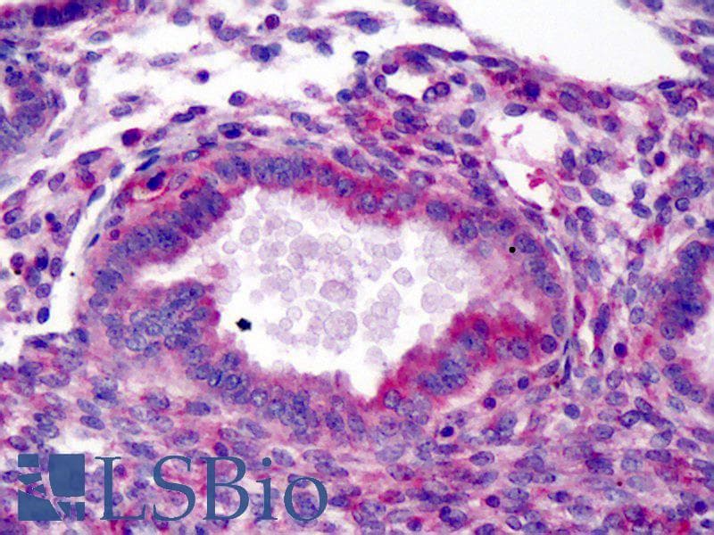 IHC-plus™ ARA9 / AIP Antibody (clone 35-2)