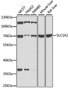 SLC1A2 / EAAT2 / GLT-1 Antibody (aa495-574)