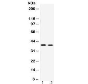 Polyclonal Rabbit anti-Human ATF4 Antibody (WB)