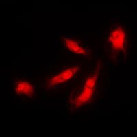 CDK5R1 Antibody (N-Terminus)