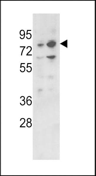ZBTB16 / PLZF Antibody (aa637-666)