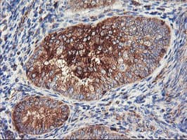 PFKP Antibody (clone OTI3H8)