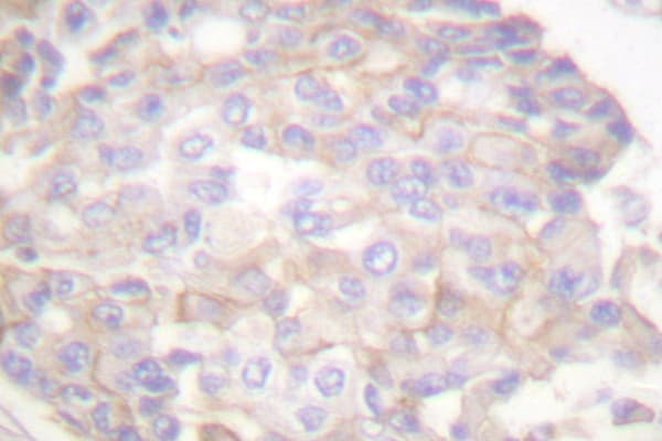 ANXA6/Annexin A6/Annexin VI Antibody (Ala5)