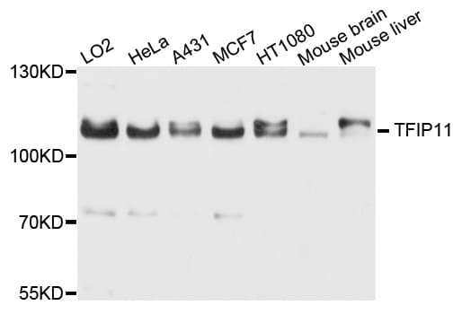 TFIP11 Antibody