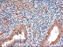MYC / c-Myc Antibody (clone OTI3F2)