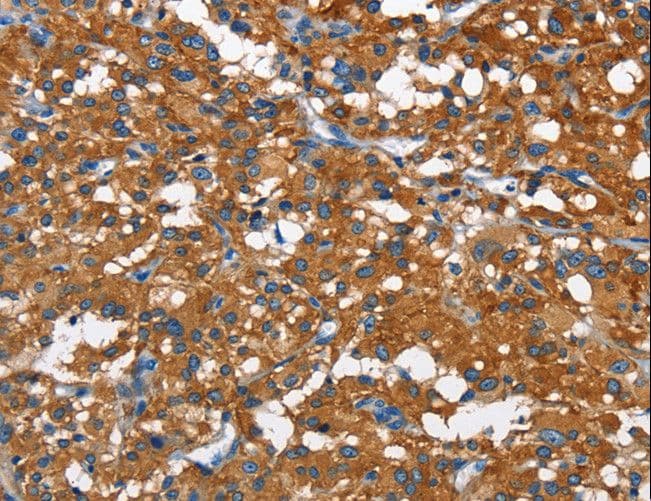 CAMK1D Antibody