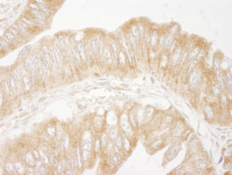 Polyclonal Rabbit anti-Human PTEN Antibody (C-Terminus, IHC, IF)