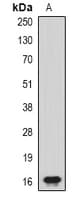 POLE3 / DNA Polymerase Epsilon Antibody