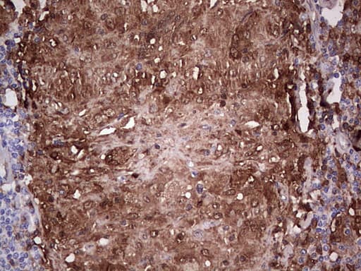 Monoclonal Mouse anti-Human LGALS3 / Galectin 3 Antibody (clone OTI15E4, Carrier-free, IHC, WB)