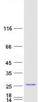 Human C9orf85 Protein (Recombinant Myc-DDK (Flag))