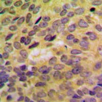 Polyclonal Rabbit anti-Human SH3GLB2 / Endophilin-B2 Antibody (Internal, IHC, WB)