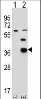 PDXK / PNK Antibody (aa1-30)