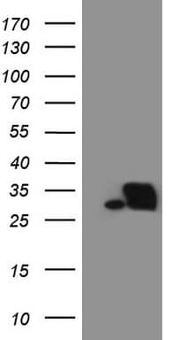 SNRPB2 Antibody (clone OTI3D9)
