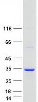 Human SCAND1 Protein (Recombinant Myc-DDK (Flag))