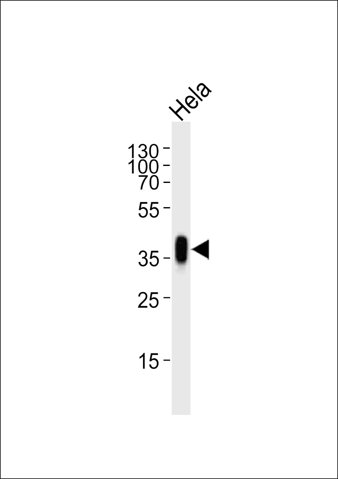 IHC-plus™ Polyclonal Rabbit anti-Human FOLR1 / Folate Receptor Alpha Antibody (IHC, WB)