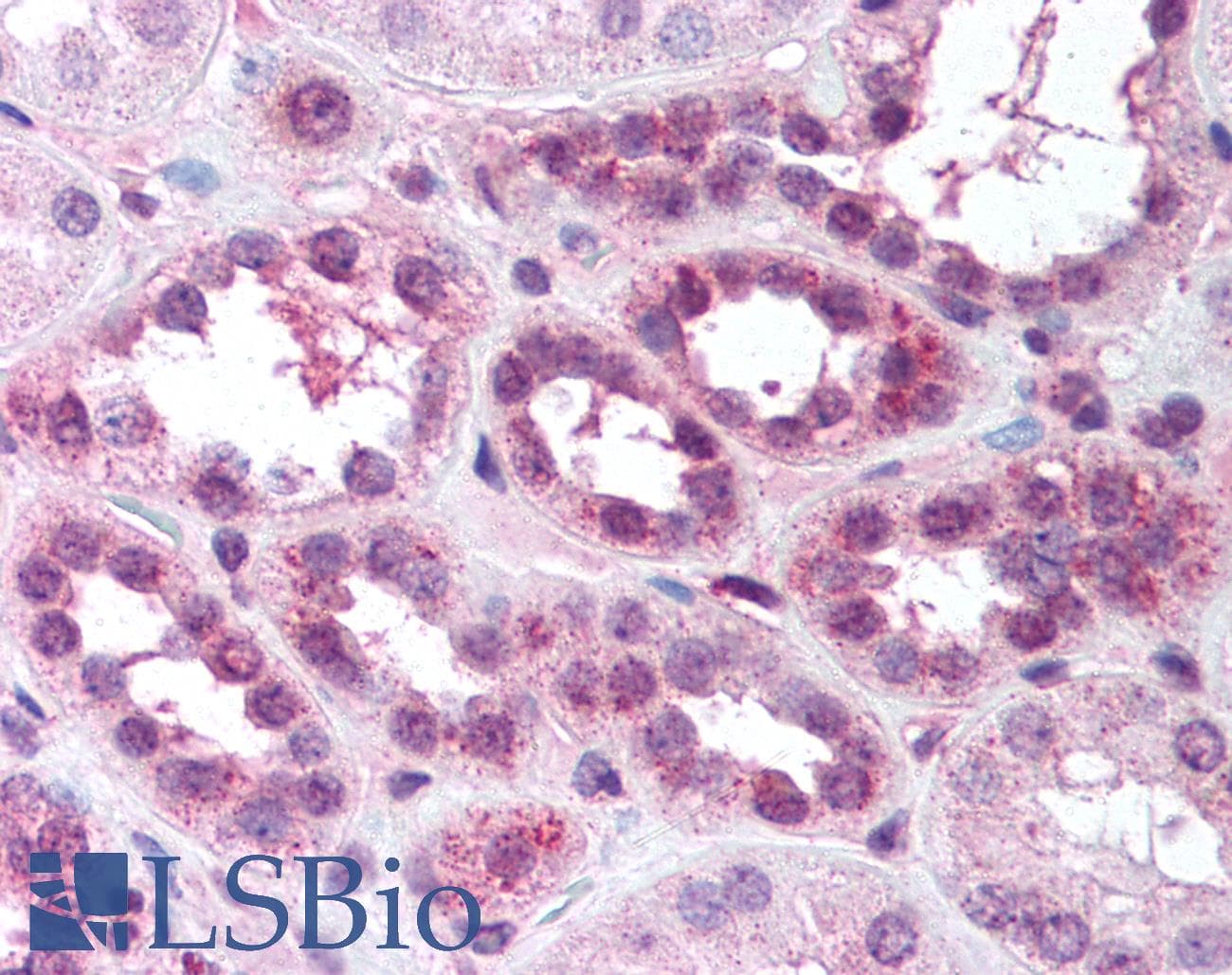 IHC-plus™ Polyclonal Rabbit anti-Human RELA / NFKB p65 Antibody (phospho-Ser529, IHC, WB)