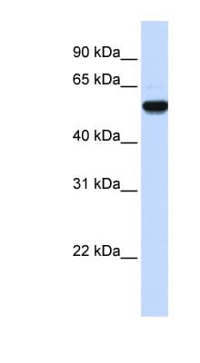 EEF1A2 Antibody (aa360-409)