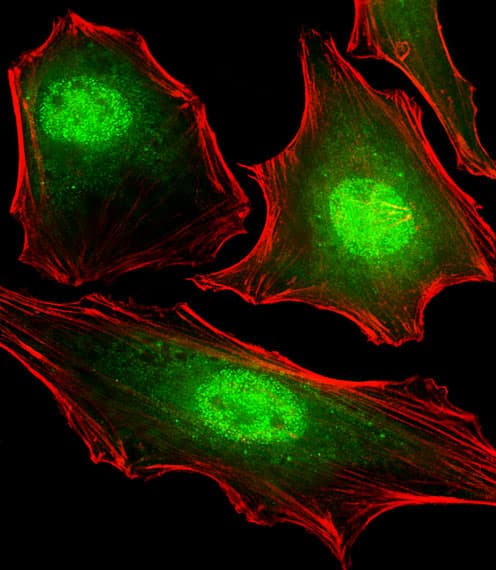 FUBP3 Antibody (N-Terminus, clone 1216CT820.155.150)