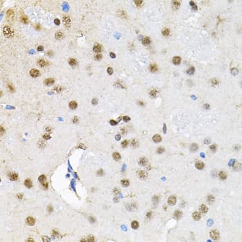 SMARCD1 / BAF60A Antibody