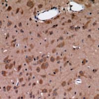 CCK4 / PTK7 Antibody
