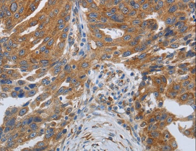 Polyclonal Rabbit anti-Human SPAG1 / TPIS Antibody (IHC, WB)