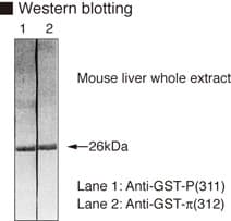 Polyclonal Rabbit anti-Human GSTP1 / GST Pi Antibody (IHC, WB)