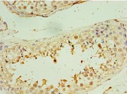 STX16 / Syntaxin 16 Antibody (aa1-300)
