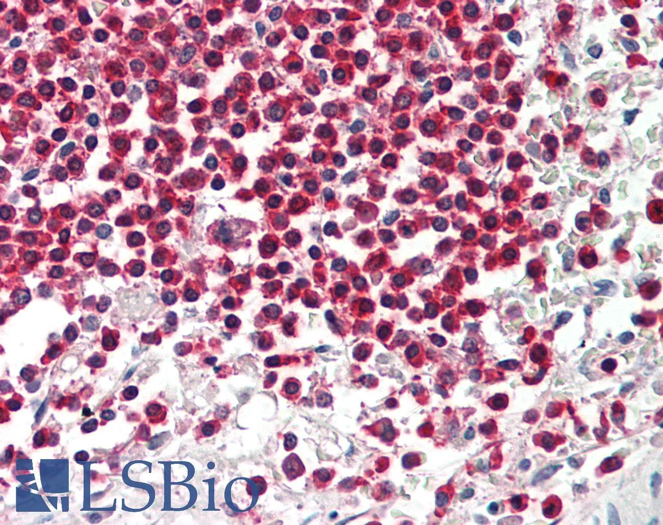 WDR6 Antibody (aa334-383)