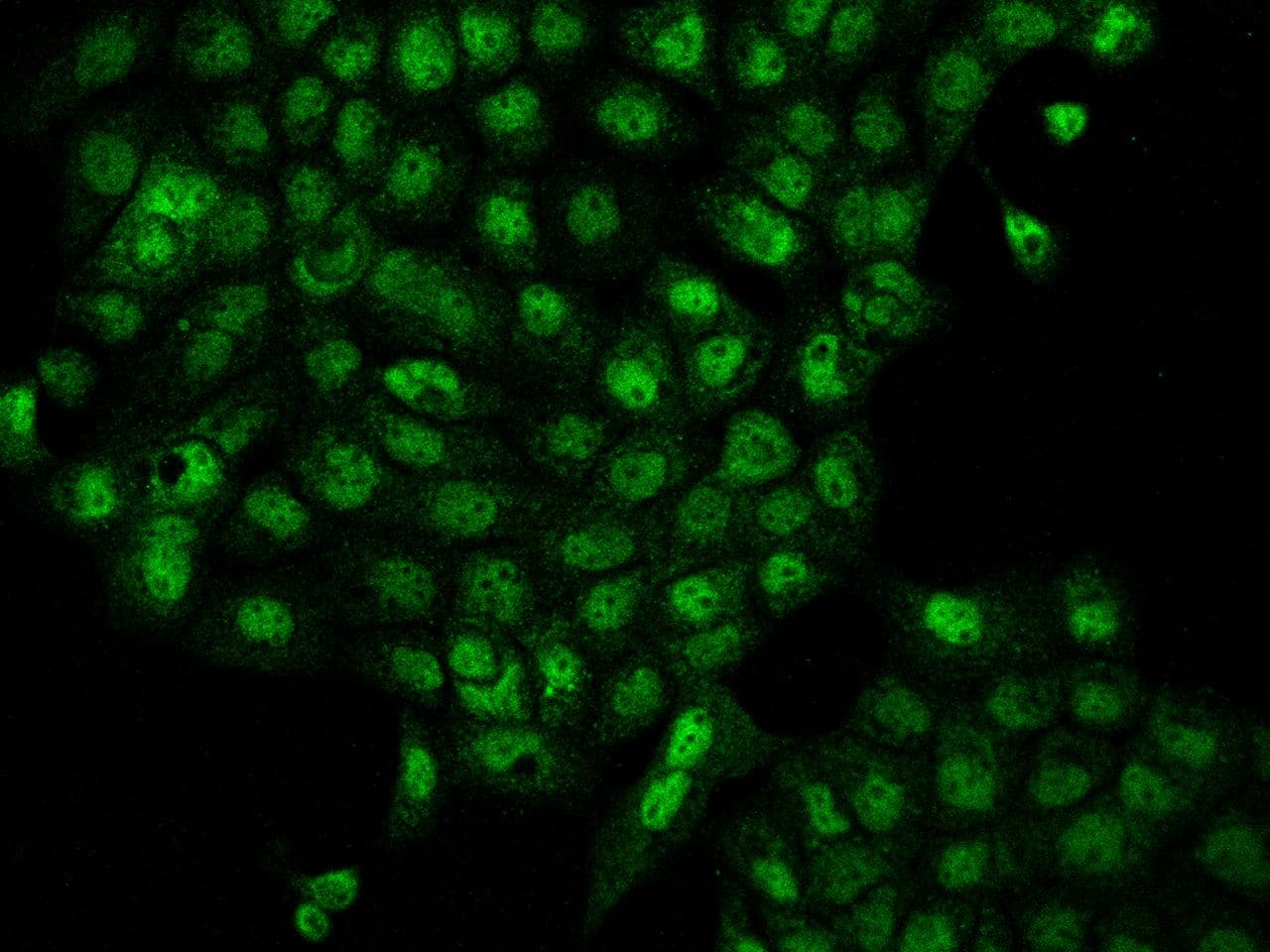 TSSC4 Antibody