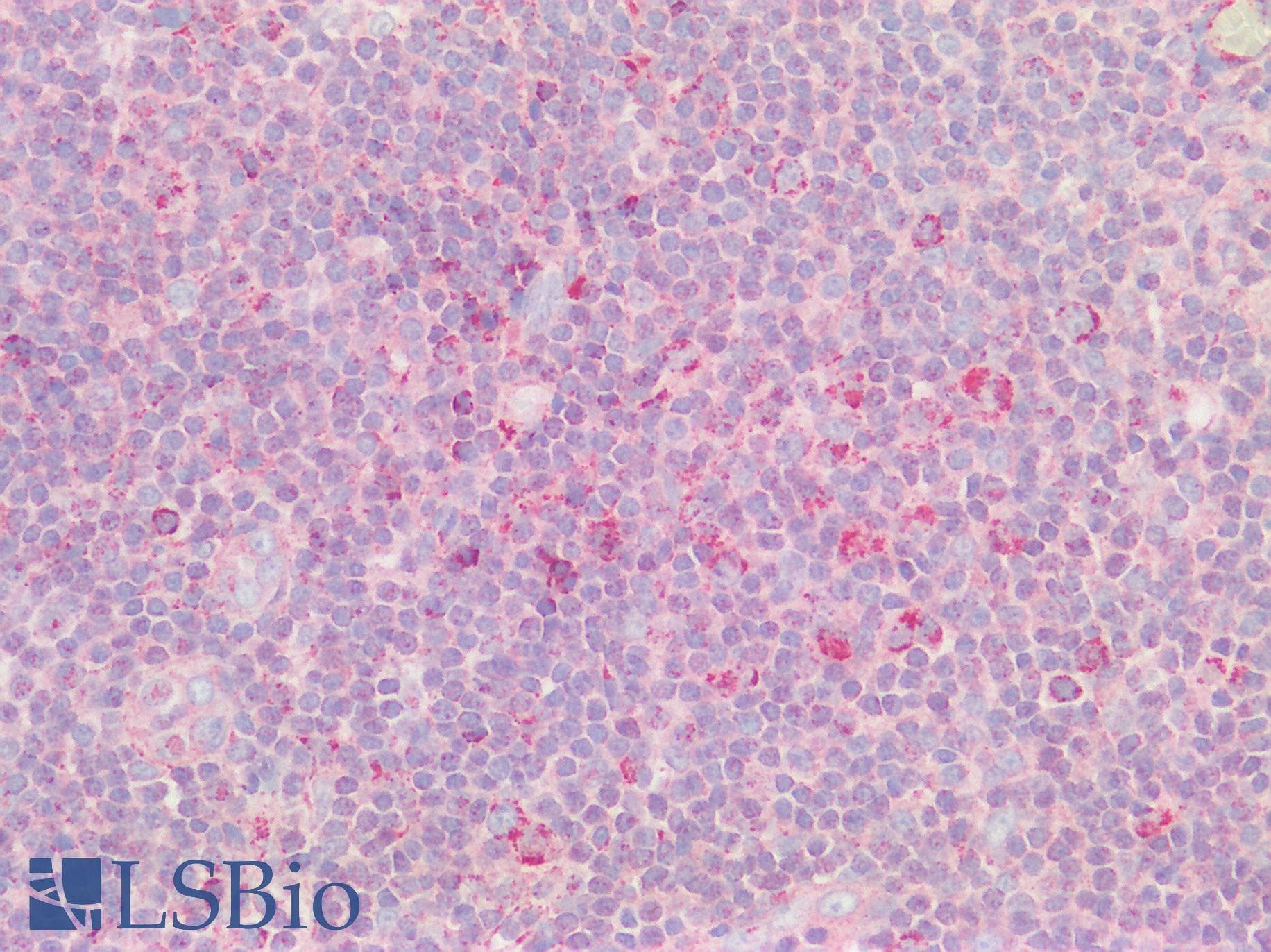 IHC-plus™ CNOT3 Antibody (aa525-575)