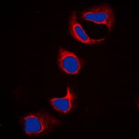 Fragilis / IFITM3 Antibody (N-Terminus)