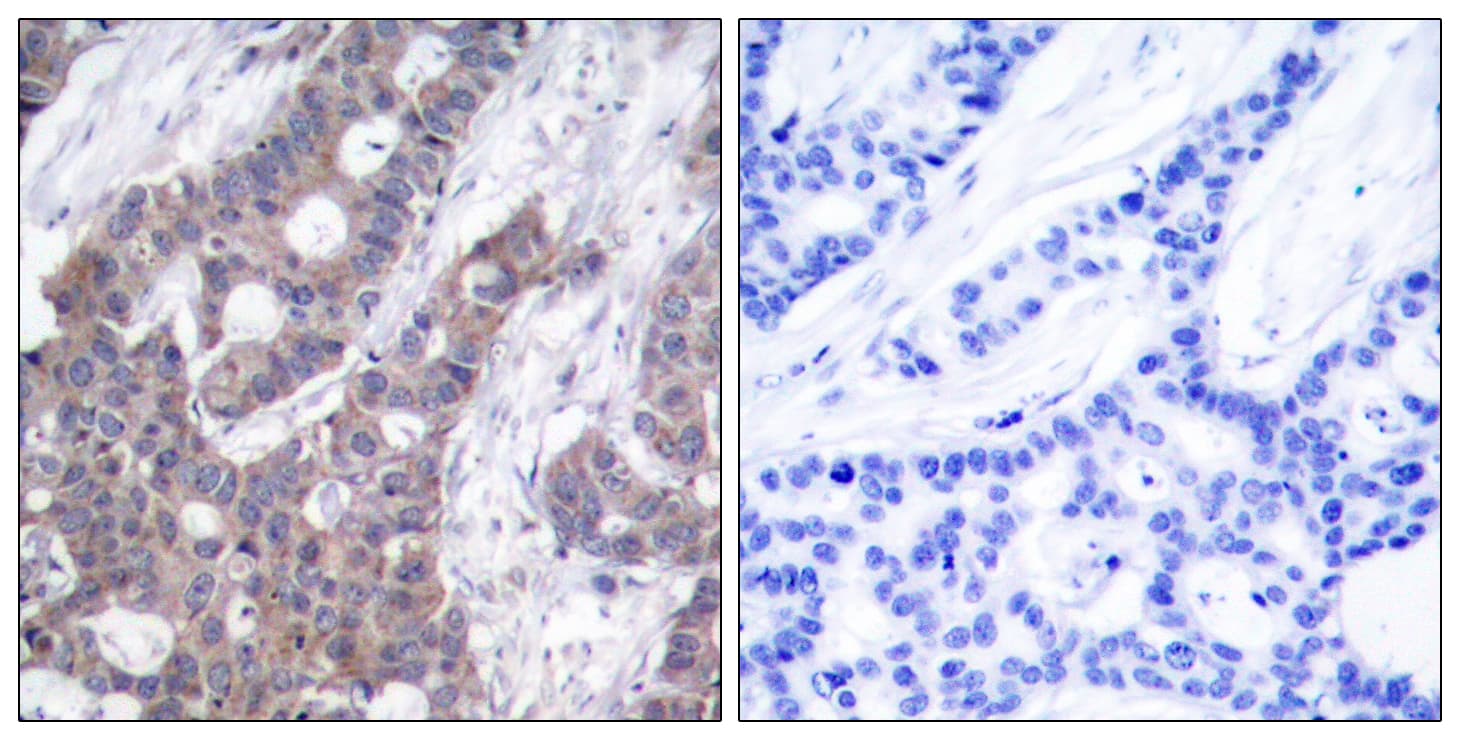 Polyclonal Rabbit anti-Human STMN1 / Stathmin / LAG Antibody (phospho-Ser15, IHC, IF, WB)