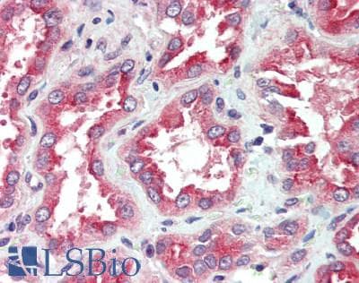 IHC-plus™ Polyclonal Rabbit anti-Human SLC22A1 Antibody (IHC, WB)