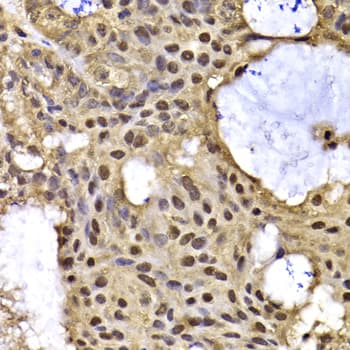 Polyclonal Rabbit anti-Human ARID3A / DRIL1 Antibody (IHC, WB)