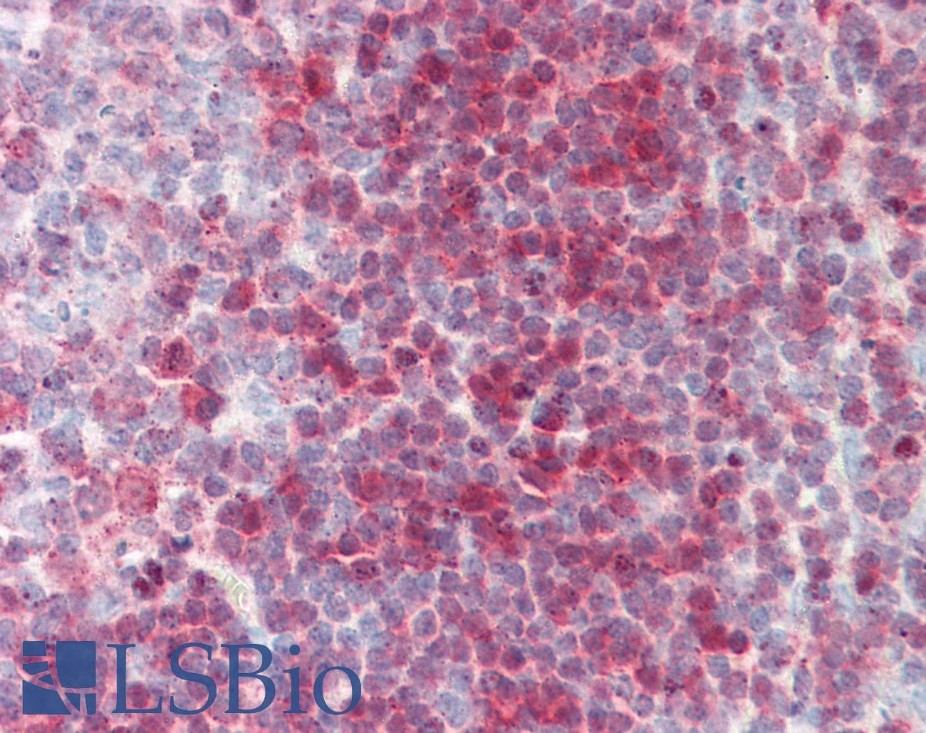 IHC-plus™ PNP / Nucleoside Phosphorylase Antibody (aa142-153)