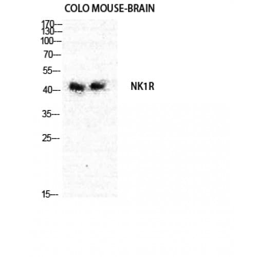 Polyclonal Rabbit anti-Human TACR1 / NK1R Antibody (180-260 aa, Internal, IF, WB)
