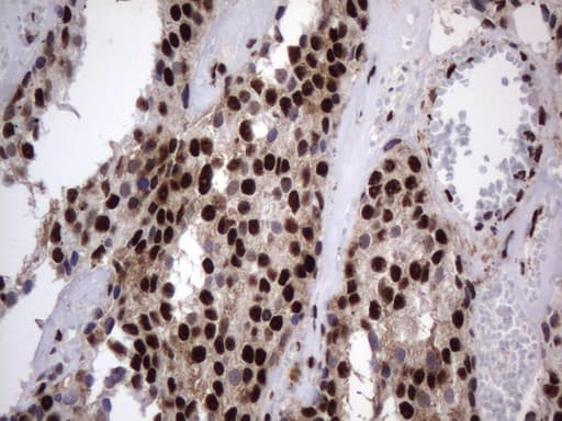 Monoclonal Mouse anti-Human DDX56 Antibody (clone UMAB152, Carrier-free, aa323-547, IHC, IF, WB)
