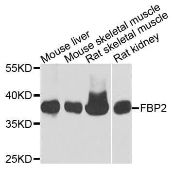 FBP2 Antibody