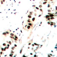JUN / c-Jun Antibody (phospho-Ser73/100)