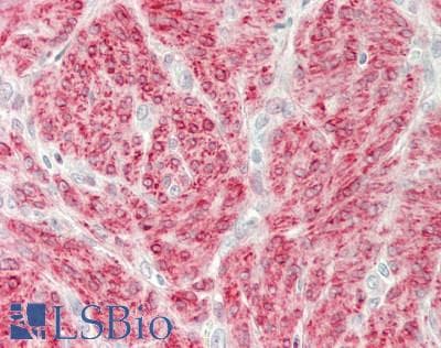 IHC-plus™ PKG / PRKG1 Antibody