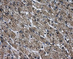 LOX / Lysyl Oxidase Antibody (clone OTI6B7)