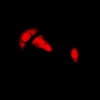 Polyclonal Rabbit anti-Human ER Alpha / Estrogen Receptor Antibody (Internal, IHC, IF, WB)