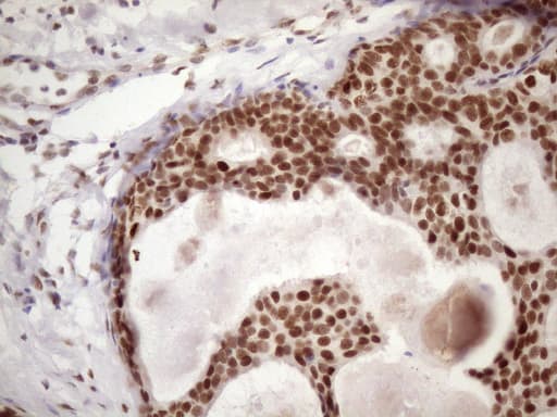 TP53BP1 / 53BP1 Antibody (aa1-300, clone OTI2H6)