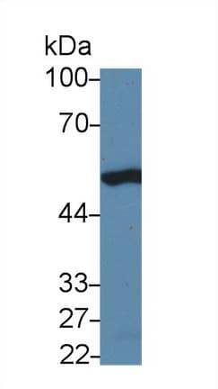 TP53 / p53 Antibody (aa90-354)