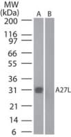 Polyclonal Rabbit anti-Variola Virus Smallpox-A27L Antibody (aa42-56, WB)