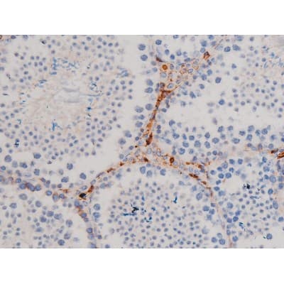 CDC25A Antibody (phospho-Ser75)