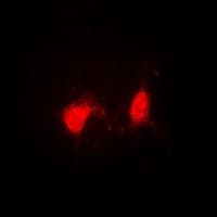 SSNA1 Antibody