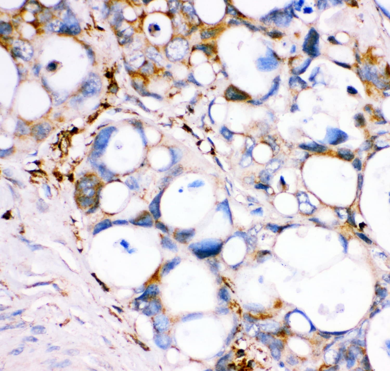 Polyclonal Rabbit anti-Human GPX1 / Glutathione Peroxidase Antibody (aa116-146, IHC, WB)