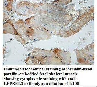 P3H3 / LEPREL2 Antibody (aa400-579)