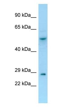 SNX2 Antibody (C-Terminus)